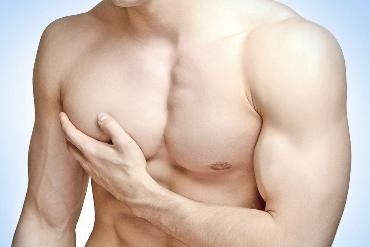 Press Room Image Gynecomastia  - A Common Side Effect Of Steroid Use