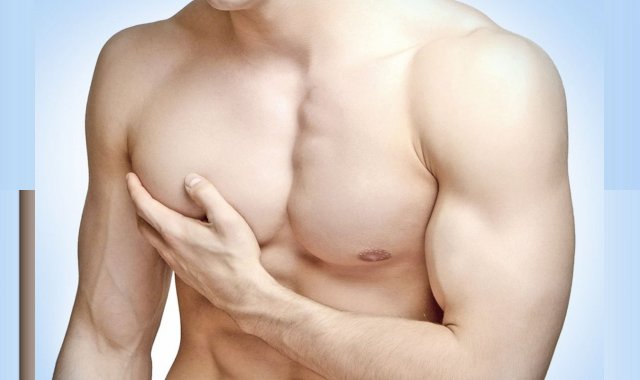 Gynecomastia  - A Common Side Effect Of Steroid Use